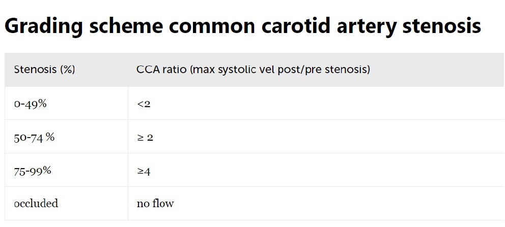 https://www.123sonography.com/carotid-artery-stenosis-part-2-spectral-doppler